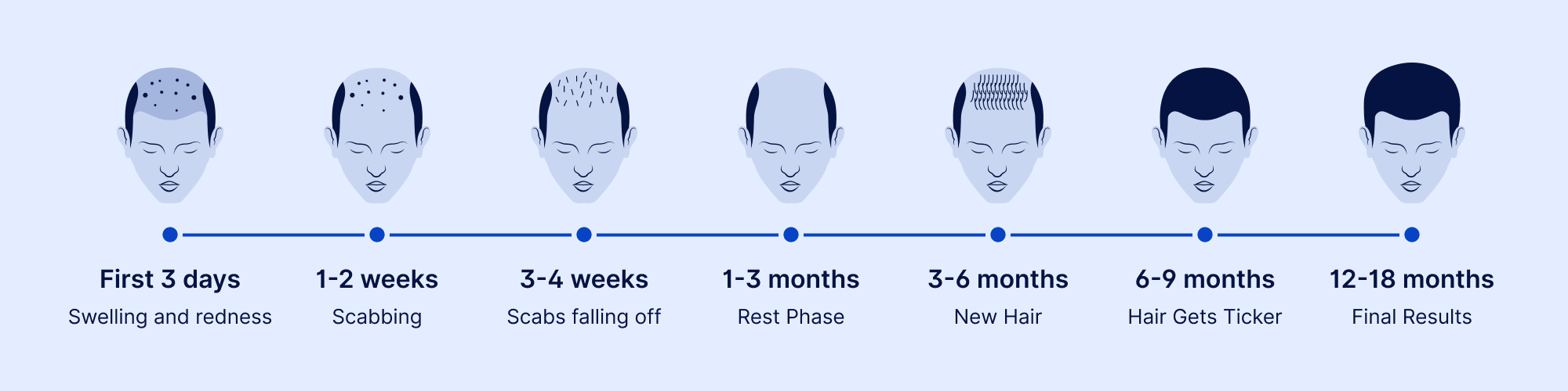 Hair transplant recovery timeline